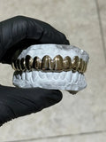 Gold Grillz