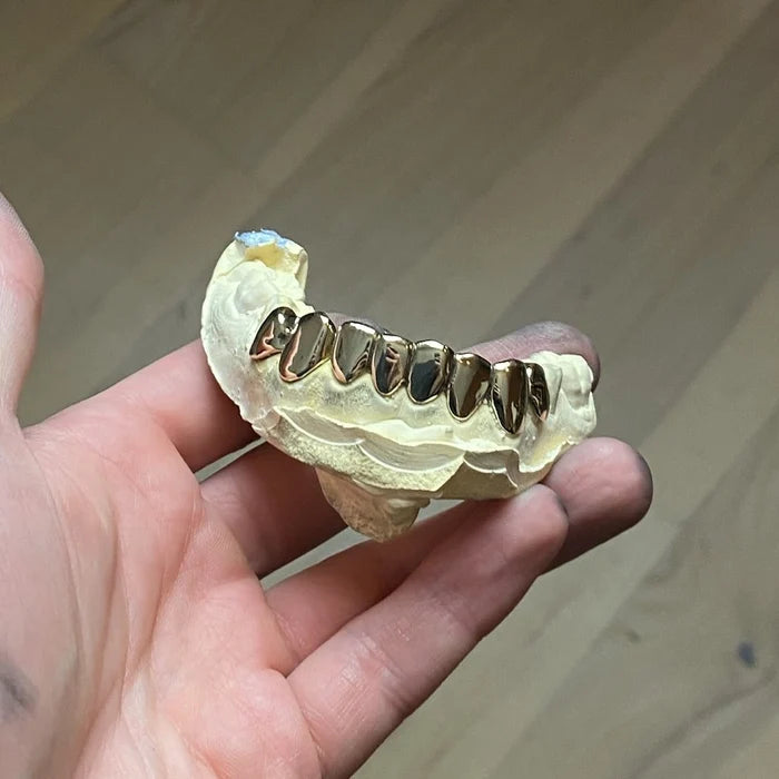 The Classic Gold Grillz