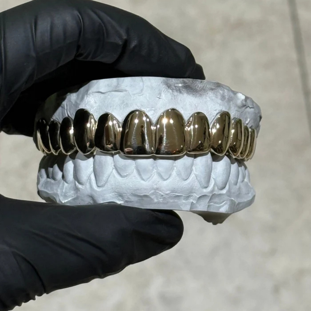 The Classic Gold Grillz