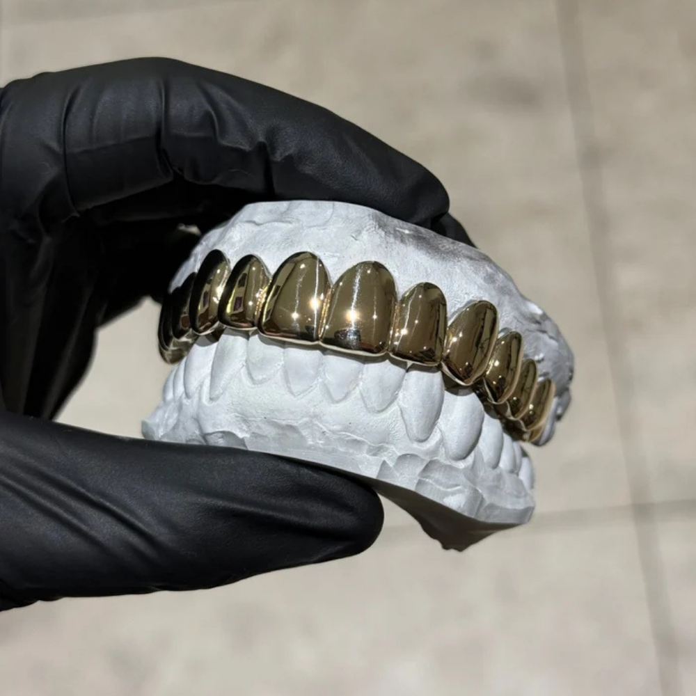 The Classic Gold Grillz