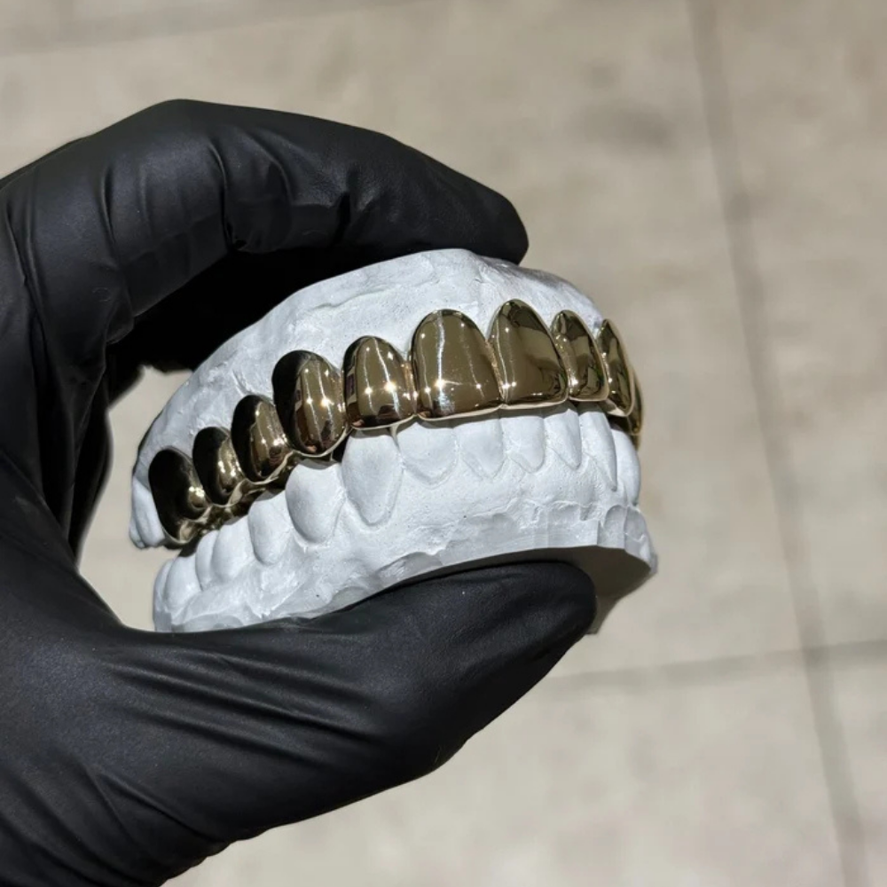 The Classic Gold Grillz