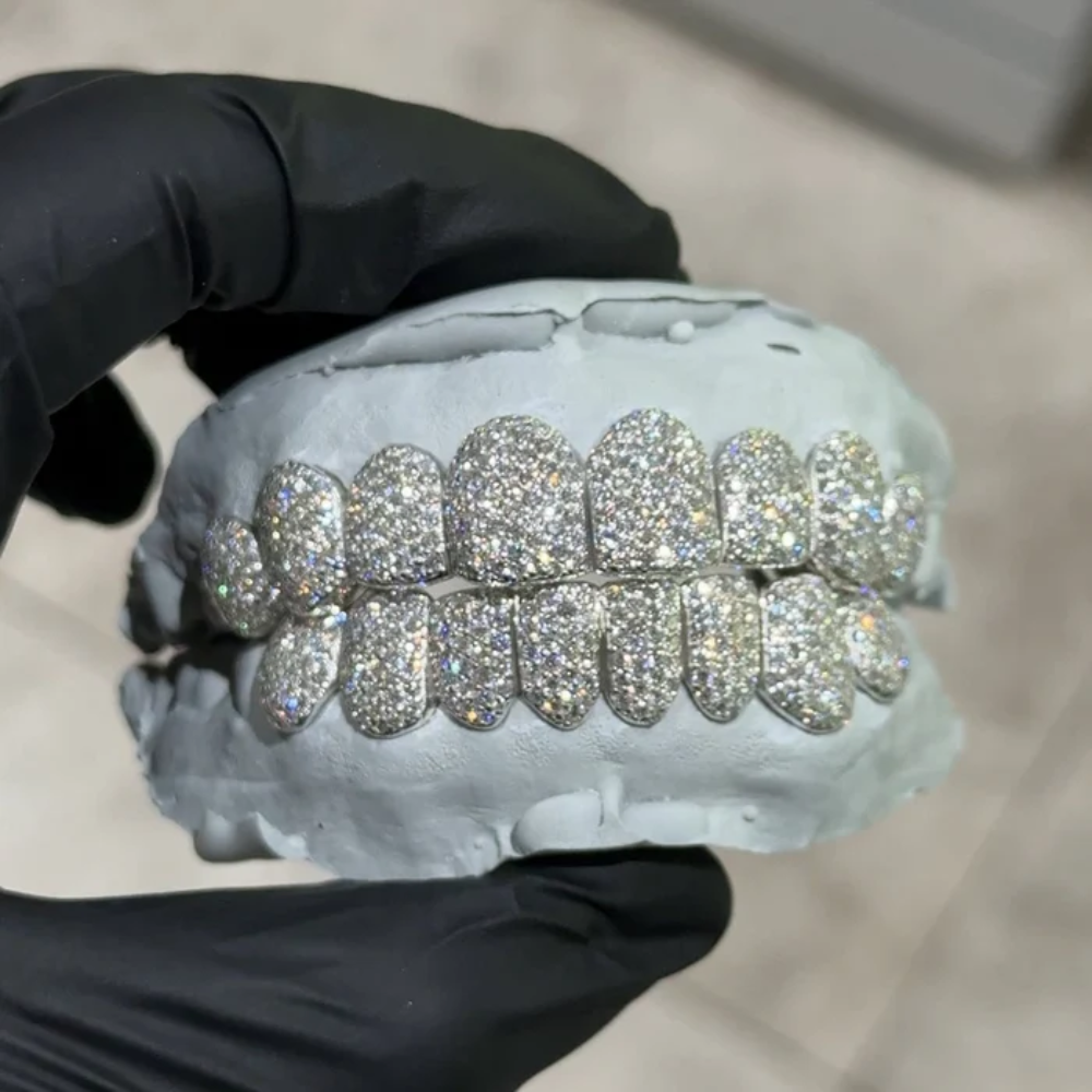 The Gold Iced Moissanite Grillz