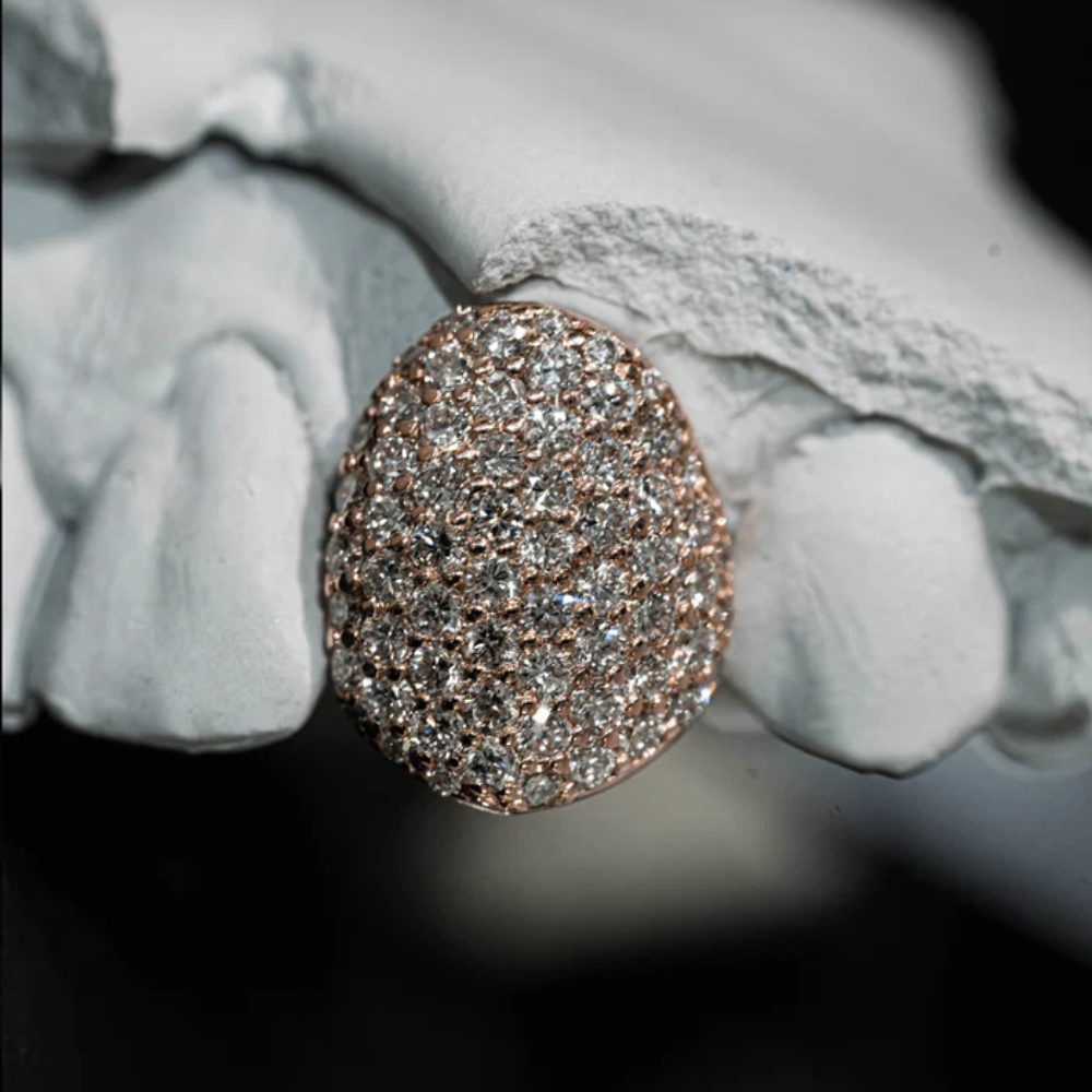 The Gold Iced Moissanite Grillz