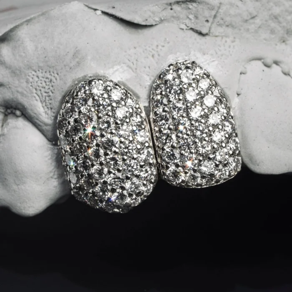 The Gold Iced Moissanite Grillz