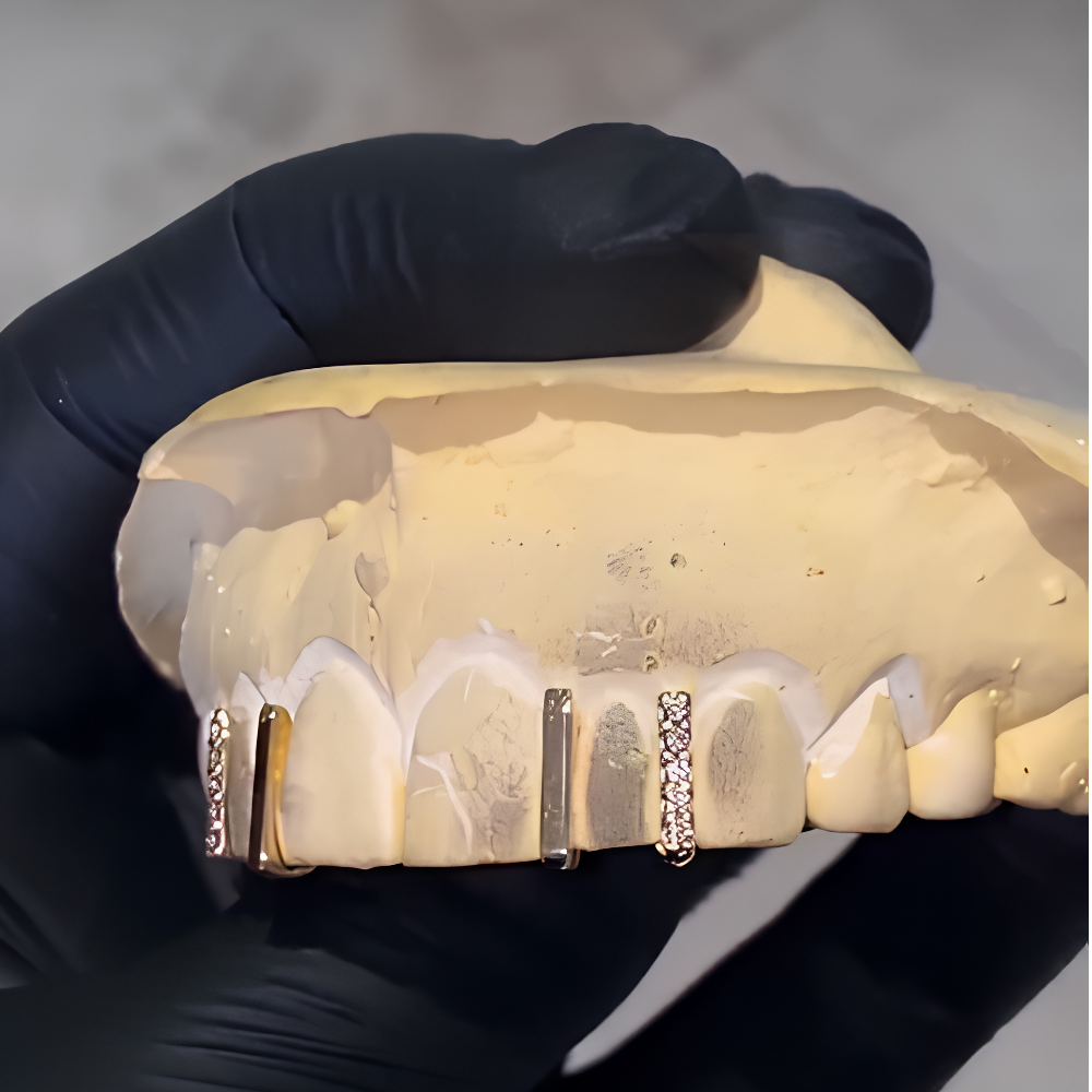 The Iced Gap Filler